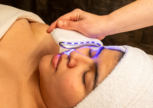 Scens Hydra Défense